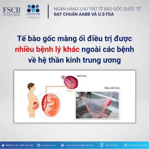 tế bào gốc màng ối